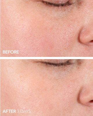 dennis gross pore perfecting