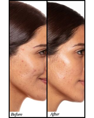 A+ High Dose Retinoid Serum 0.5 oz.