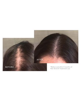 Flourish Nightly Intensive Hair Rejuvenation Treatment - 30 Days