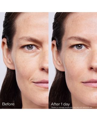 Bio Performance Skin Filler Serums Refill Set