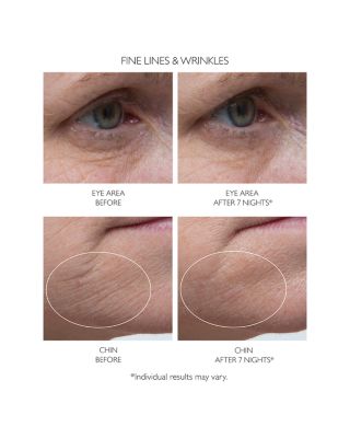 Retinol Fusion PM Night Serum 1 oz.