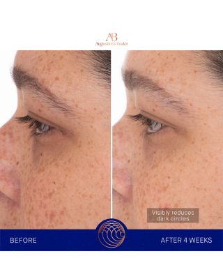 The Eye Patches, Pack of 6