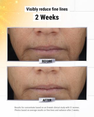 Powerful-Strength Line-Reducing Concentrate 1.7 oz.