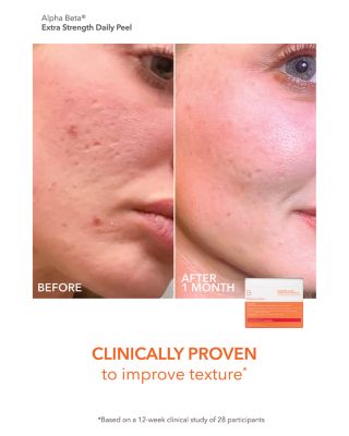 Alpha Beta Daily Peel Vault ($245 value)