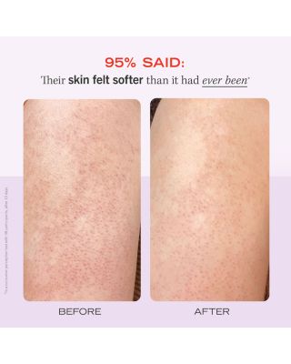 KP Bump Eraser Body Scrub with 10% AHA Body Exfoliant for Keratosis Pilaris - Strawberry 2 oz.