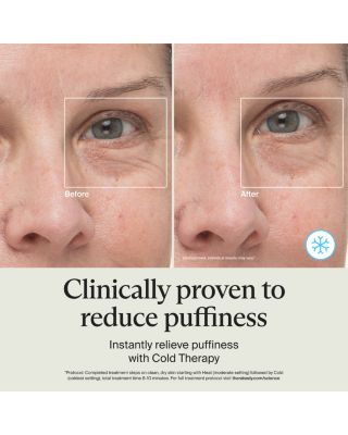 TheraFace Depuffing Wand