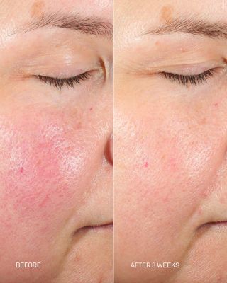 DNA Repair Complex 0.5 oz.