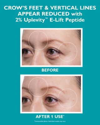 Peptide Skinjection Expression Line Hydra Gel Patches