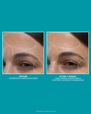 Peptide Skinjection Moisture Infusion Cream Refill Pod 1.7 oz.