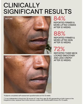 InstaFacial&reg; Collection Infusion Serum 1.18 oz.