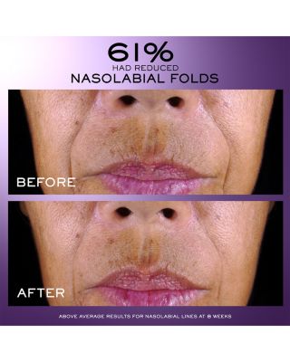 R&eacute;nergie C.R.x. Triple Serum Retinol 1.7 oz.