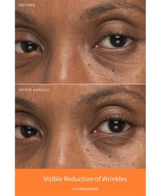 First Care Activating Serum VI 2 oz.