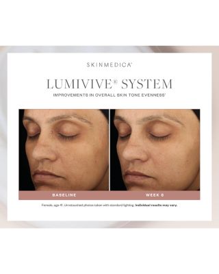 Lumivive System