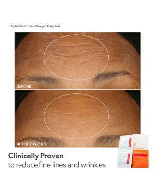 The Peel Vault ($245 value)