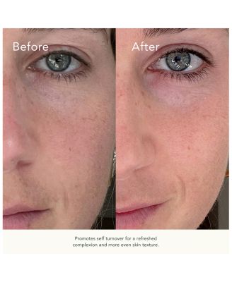 Retin C Treatment Complex 1 oz.