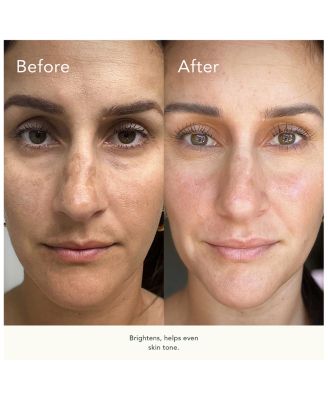 BioCell Correcting Serum 1 oz.