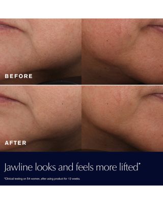 Double Your Glow Revitalizing Supreme+ Moisturizer Refill Skincare Gift Set ($218 value)