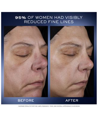 G&amp;eacute;nifique Ultimate Face Serum Skincare Gift Set ($183 value)