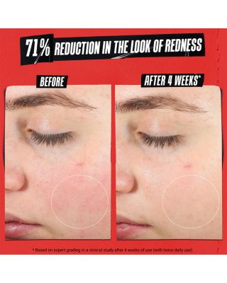 Ultra Facial Meltdown Recovery Medicated Cream with Colloidal Oatmeal 1.7 oz.