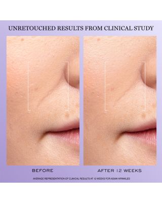 R&eacute;nergie Discovery Gift Set ($135 value)