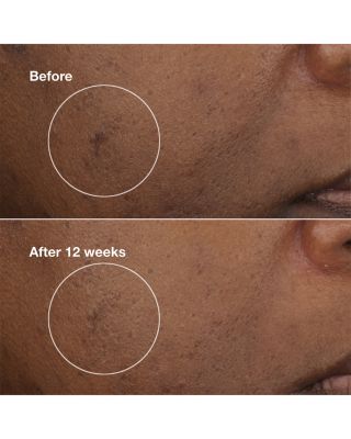 Brightening Routine Mini Even Better Skincare Gift Set ($51 value)