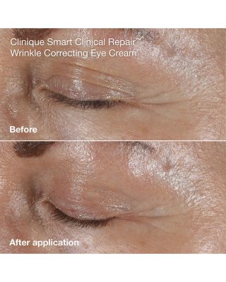 Smart Clinical Repair Mini Skincare Gift Set ($71 value)