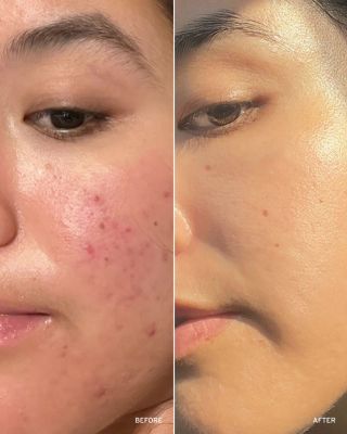 Retinol Peptide Booster Serum 1 oz.