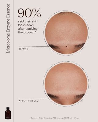 Microbiome Enzyme Essence 4 oz.