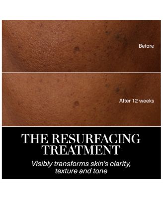 The Resurfacing Treatment 3.4 oz.