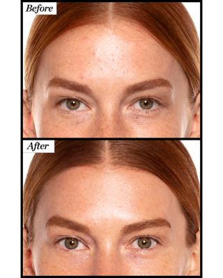 A+ High Dose Retinoid Serum 0.5 oz.