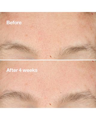 Clarifying Do-Over Peel Peeling Exfoliant 1 oz.