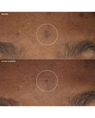 Even Better Clinical Brightening Moisturizer 0.5 oz.