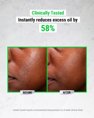 Ultra Pure High-Potency Serum 5.0% Niacinamide 1 oz.