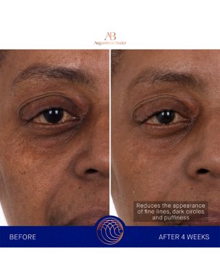 The Eye Patches, Pack of 6