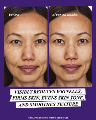 Retinol Skin-Renewing Daily Micro-Dose Serum 1 oz.