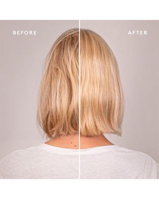 Recovery Discovery Set