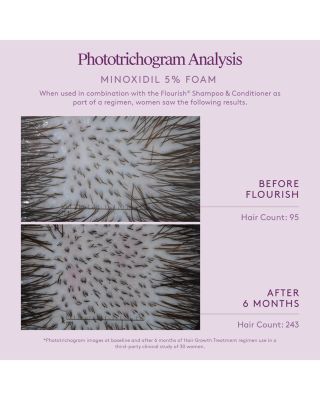 Flourish Minoxidil Foam
