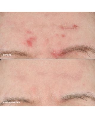 Vitamin Enriched Smoothing Serum with Niacinamide 1.01 oz.