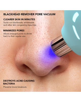 KIWI Blackhead Remover
