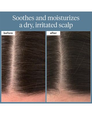 Scalp Revival Rosemary Pre-Wash Oil for Hair &amp; Scalp 3.4 oz.