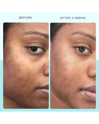 Dark Spot Serum with Niacinamide 1 oz.