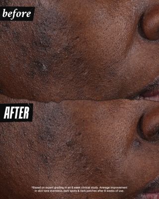 Auto Tone Discoloration & UV Solution 1.4 oz.