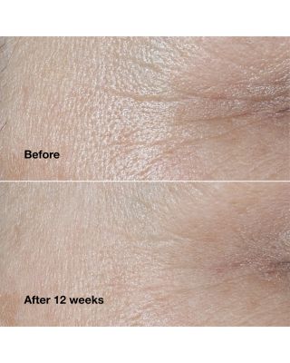 Smart Clinical Repair Wrinkle Correcting Cream Mini 0.5 oz.