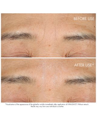 Capture Totale Hyalushot Wrinkle Corrector With Hyaluronic Acid 0.5 oz.