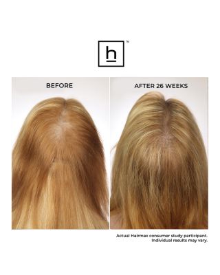 LaserBand 41 ComfortFlex Hair Growth Device