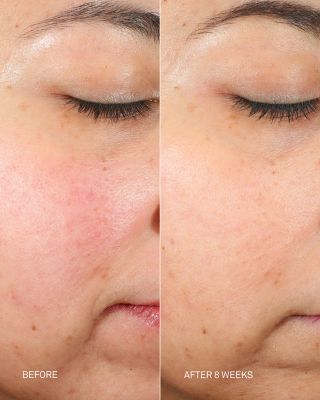 DNA Repair Complex 0.5 oz.