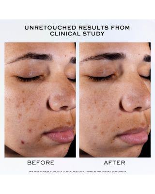 Clarifique Pro Solution Brightening & Dark Spot Reducing Serum 1.7 oz.