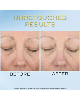 UV Expert Supra Screen Invisible Sunscreen Serum SPF 50 1.7 oz.