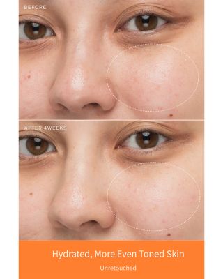 First Care Trial Kit ($86 value)