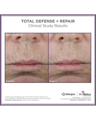 Total Defense + Repair SPF 34 Sunscreen 2.3 oz.